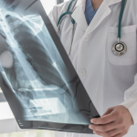 Dra. Thaline Neves destaca que a radiologia é essencial para diagnosticar precocemente e planejar o tratamento do câncer com precisão.